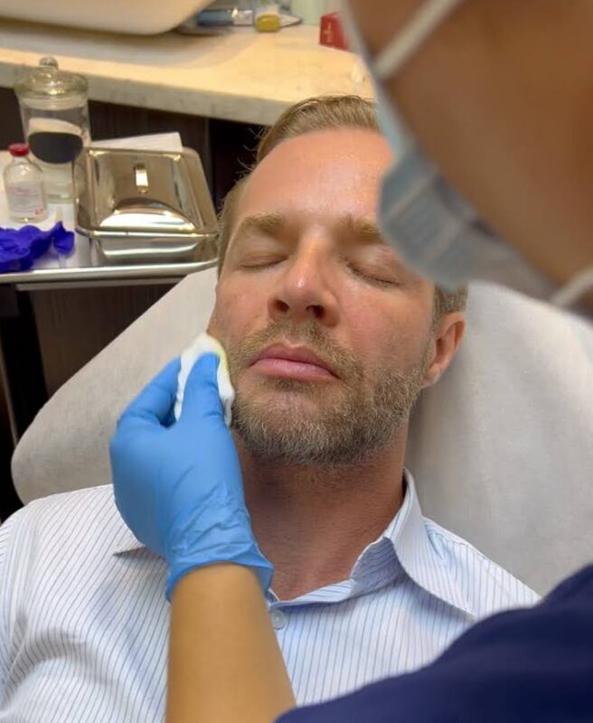 No manipules las lesiones de acné