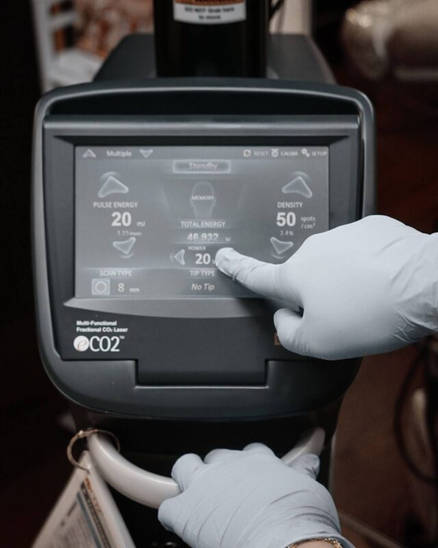 Qué trata el Láser CO2