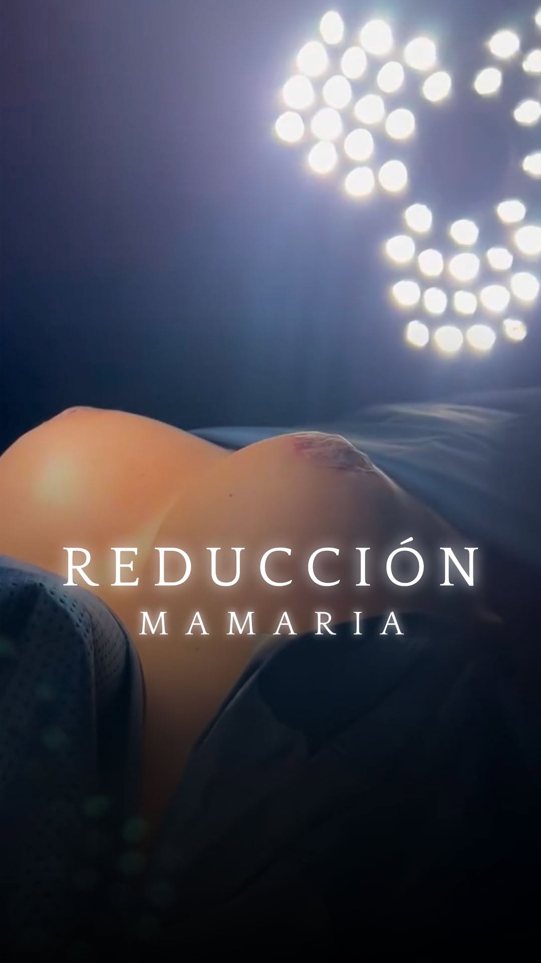 Reel 1