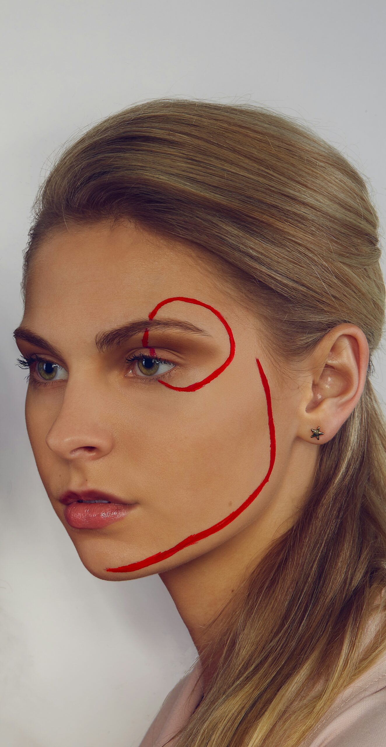 Perfil mandibular definido